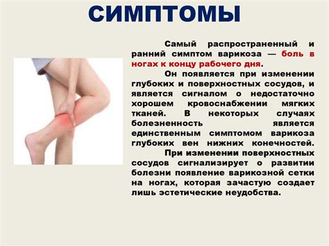 Варикозное расширение вен нижних конечностей - презентация онлайн