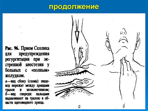 Основы реаниматологии - презентация онлайн