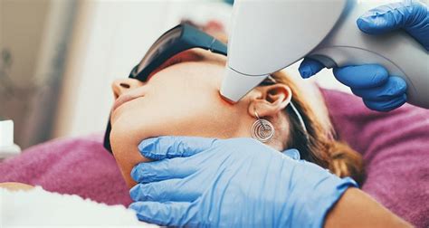laser hair removal cost