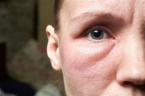 potential reasons   face  swollen