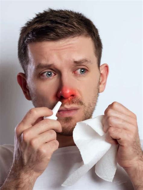 Breathe Easy At Home: 5 Simple Remedies To Unstuff Your Nose