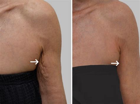 defying gravity solutions  firming sagging skin