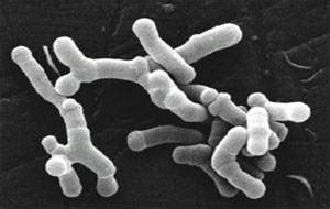 Bifidobacterium Longum - Bifidobacterium Longum Probiotic