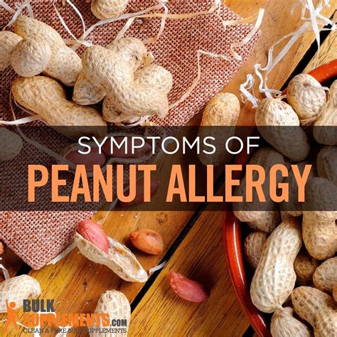 Peanuts Food Allergy at Blanche Howard blog