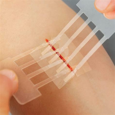 Clozex Emergency Laceration Kit - FDA Cleared Skin Closure Device for
