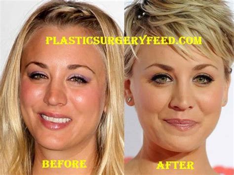 Kaley Cuoco | Nose job, Plastic surgery, Feel better