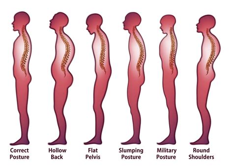 Posture and Analysis - Motion Health Centre