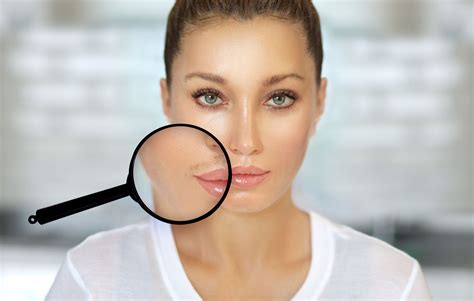 Electrolysis – The May Tree Beauty Salon, Carshalton