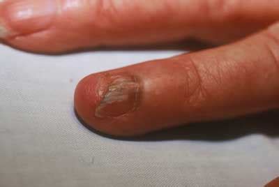 Skin and venereal diseases