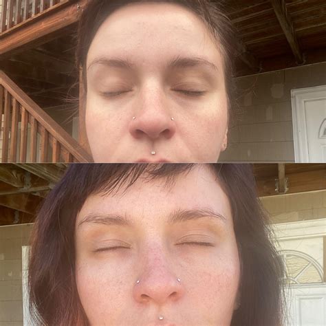Quitting Smoking Before And After Skin at Clara Garber blog
