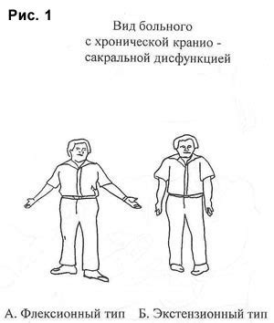 Флексия - Экстензия - Кинезиология - Прикладная Кинезиология - Лекция 4