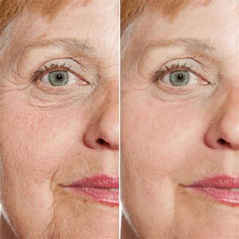 Rejuvenate Resurfacing Face Serum (3 Pack) – inblair