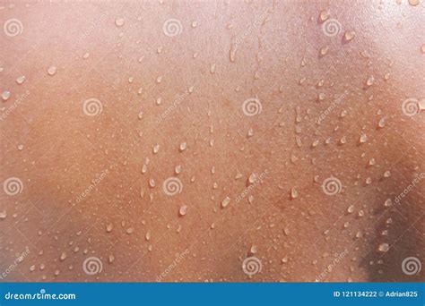 Water Drops On Woman Skin, Close Up Of Wet Human Skin Texture Stock ...
