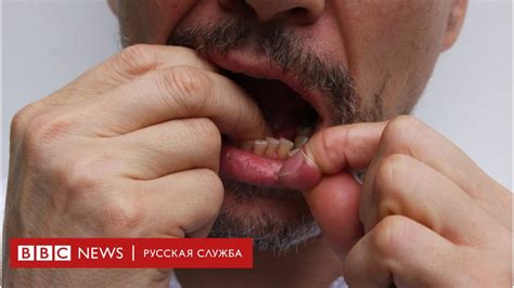 Эффективность зубной нити оказалась преувеличена - BBC News Русская служба
