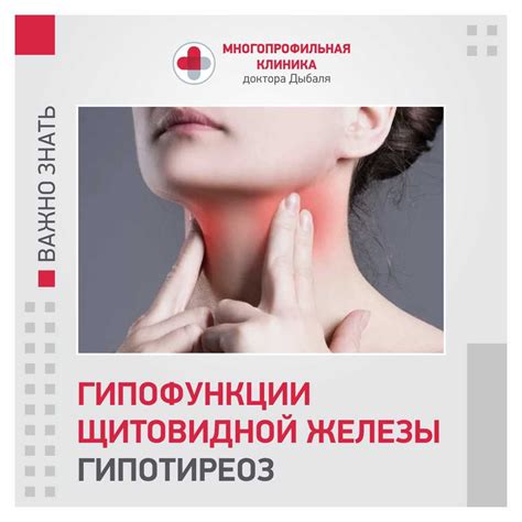 Гипофункции щитовидной железы