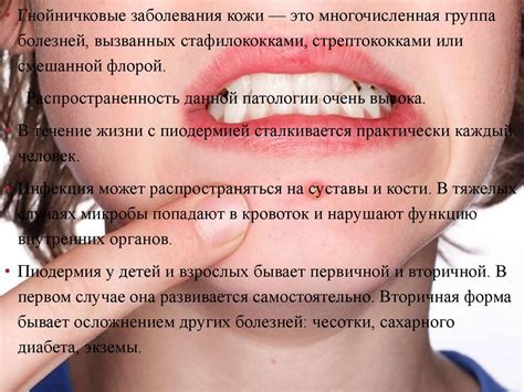 Гнойничковые заболевания кожи - презентация онлайн