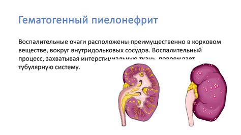 Пиелонефрит. Классификация - презентация онлайн