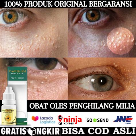 cara memutihkan dahi yang hitam secara alami 1