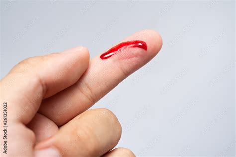 bleeding blood   cut finger wound injured finger  bleeding