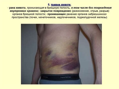 Определение степени тяжести вреда, причиненного здоровью человека ...