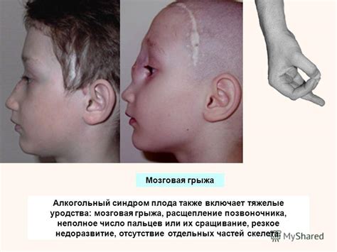 Презентация на тему: "Алкоголь – этанол (этиловый спирт, C 2 H 5 OH ...