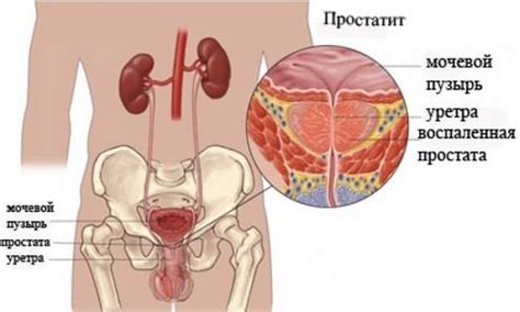Союз Аполлон - прибор для мужчин: цена, действие, отзывы, как ...