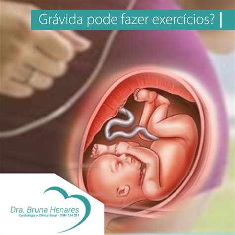 Exercicios Que Gravida Pode Fazer - Grávida pode fazer exercícios físicos?⁣ - Dra. Bruna Henares