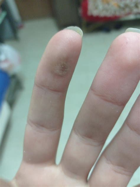 Electric shock, feeling lightheaded and my heart is going a bit too