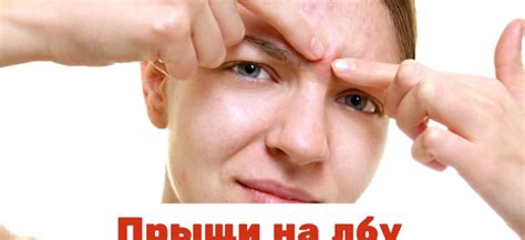 Прыщи на лбу причины у женщин и детей: причины, лечение