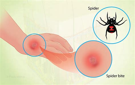 Health Condition : Symptoms, Causes, Treatment and More