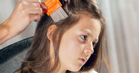 Can Hair Dye Really Kill Lice? Separating Fact from Fiction | The Lice ...