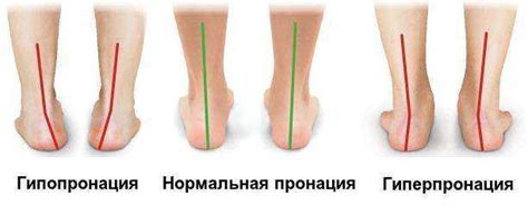 Пронация и супинация - RUNIRON