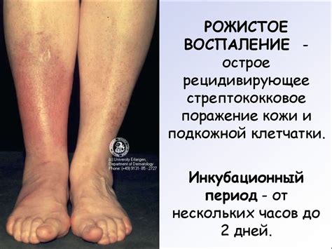 Пиодермии - презентация онлайн