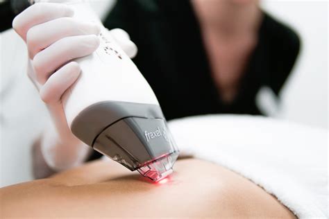 Fraxel® Dual Laser Treatment | Manhattan Dermatology