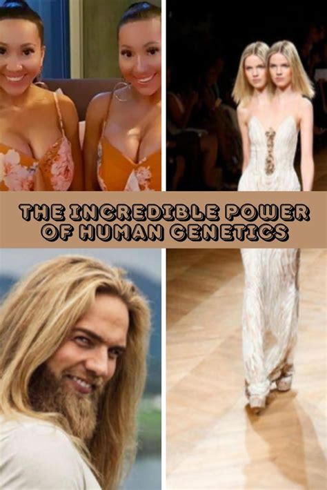 Photographs Demonstrating The Incredible Power Of Human Genetics | The ...