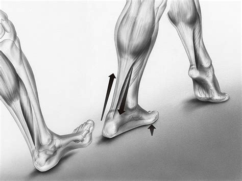 What Causes Achilles Tendonitis? - Health Journal