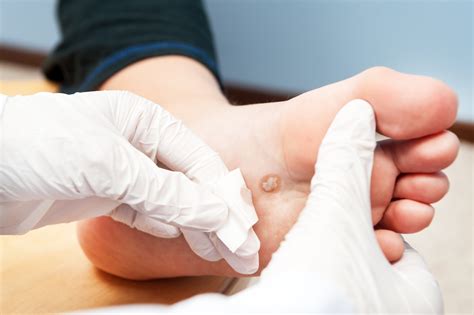 Intralesional Steroid Injection: A Comprehensive Guide for Skin