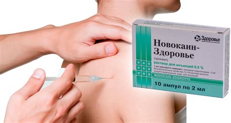 Новокаиновая блокада — показания, техника проведения, плюсы и минусы