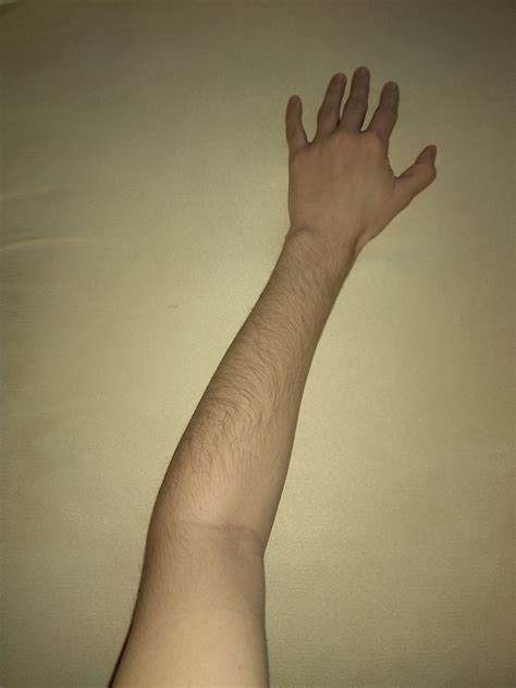 Arm Hair Does It Grow at Mitch Moore blog