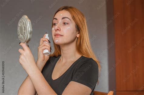 Acne and Post acne skin, scars, skin care. Concept of beauty foto de ...