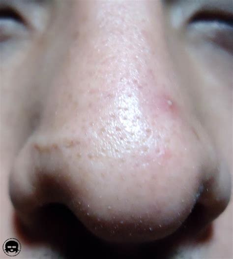 review jolse secret key black  pore  step nose pack sponsored