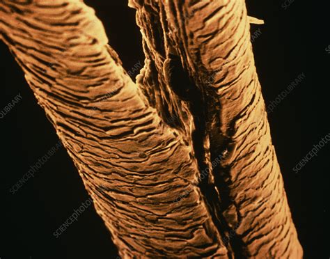 split ends close