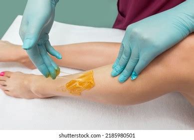 Woman Undergoing Leg Hair Removal Procedure Stock Photo 2185980501 ...