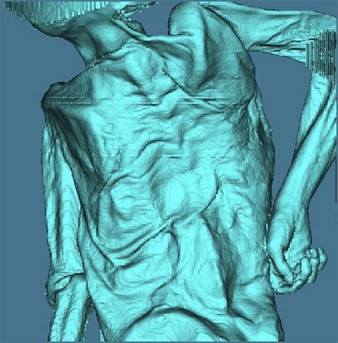 Moesgaard Museum | Inside the body