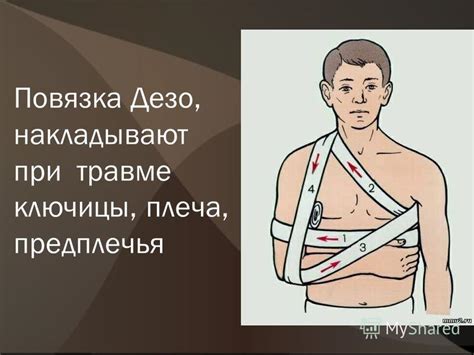 Презентация на тему: "Повязки, накладываемые на грудную клетку. Автор ...
