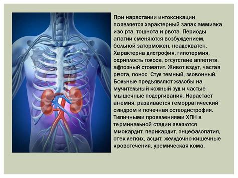 Хроническая почечная недостаточность - online presentation