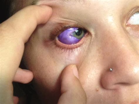 Model discovers that getting an eyeball tattoo is just as stupid and ...