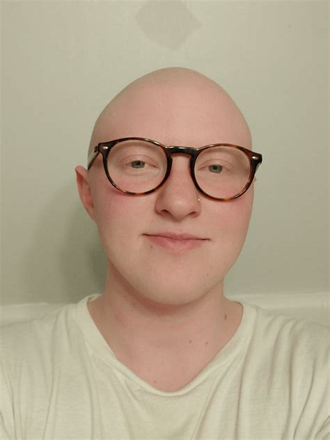 Does anyone actually look better bald? : r/bald