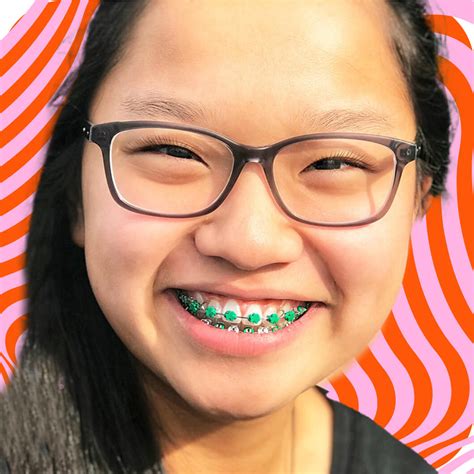 Fashion Braces Bx