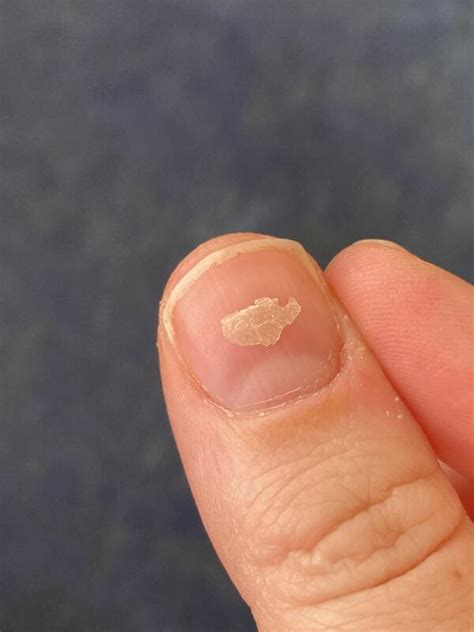 Just 21 Pretty Gross, But Let's Be Honest, Very Satisfying Pictures
